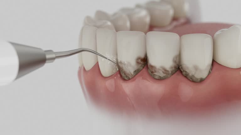 Reliable Tooth Extraction contractor in Wanaque, NJ by Smile Center Dentistry